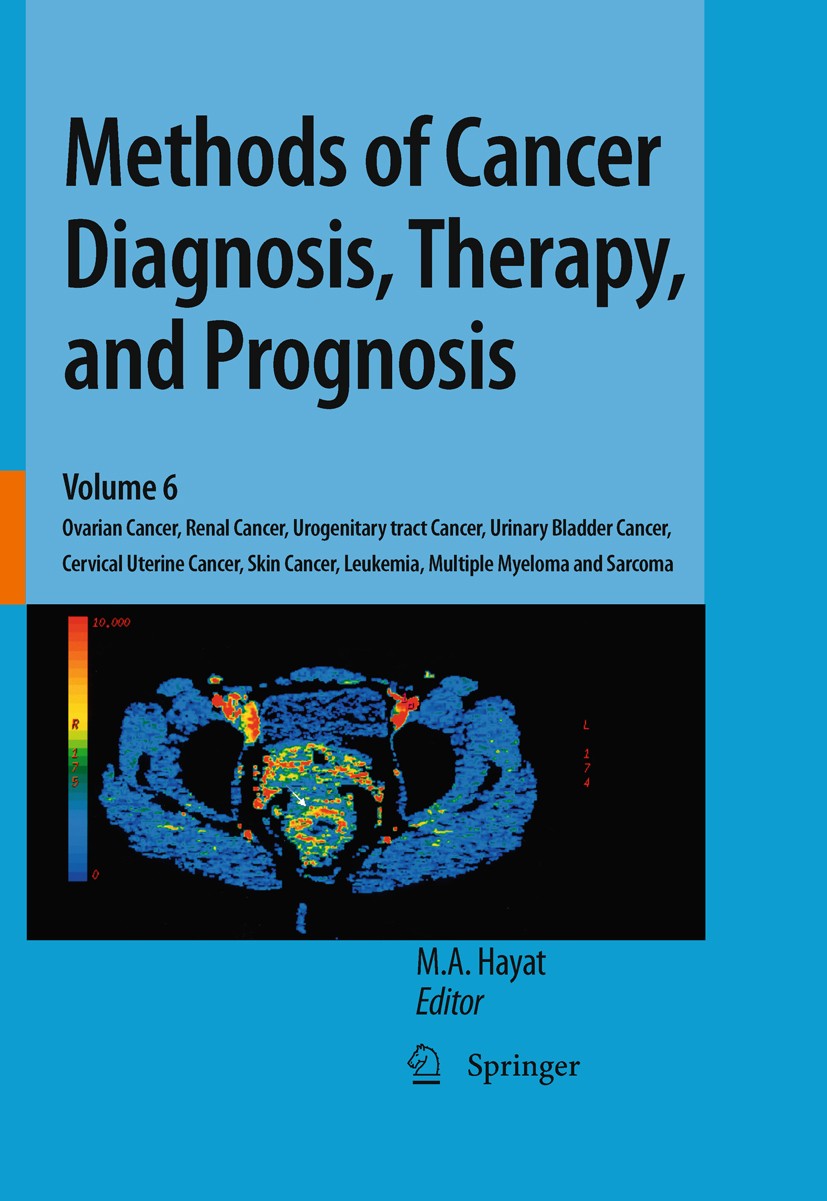 Titlebook: Methods of Cancer Diagnosis, Therapy, and Prognosis; Ovarian Cancer, Rena M. A. Hayat Book 2010 Springer Science+Business Media B.V. 2010 C Titlebook: Methods of Cancer Diagnosis, Therapy, and Prognosis; Ovarian Cancer, Rena M. A. Hayat Book 2010 Springer Science+Business Media B.V. 2010 C