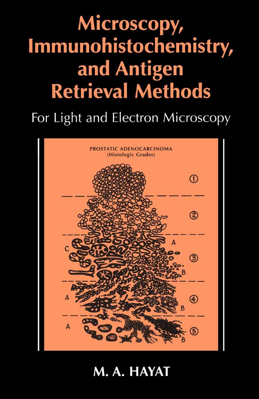 Titlebook: Microscopy, Immunohistochemistry, and Antigen Retrieval Methods; For Light and Electr M. A. Hayat Book 2002 Springer Science+Business Media Titlebook: Microscopy, Immunohistochemistry, and Antigen Retrieval Methods; For Light and Electr M. A. Hayat Book 2002 Springer Science+Business Media