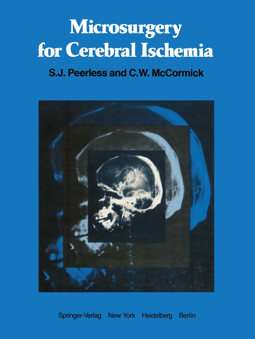 Titlebook: Microsurgery for Cerebral Ischemia; S. J. Peerless (Professor of Neurosurgery, Chairma Book 1980 Springer-Verlag New York Inc. 1980 Hirndu Titlebook: Microsurgery for Cerebral Ischemia; S. J. Peerless (Professor of Neurosurgery, Chairma Book 1980 Springer-Verlag New York Inc. 1980 Hirndu