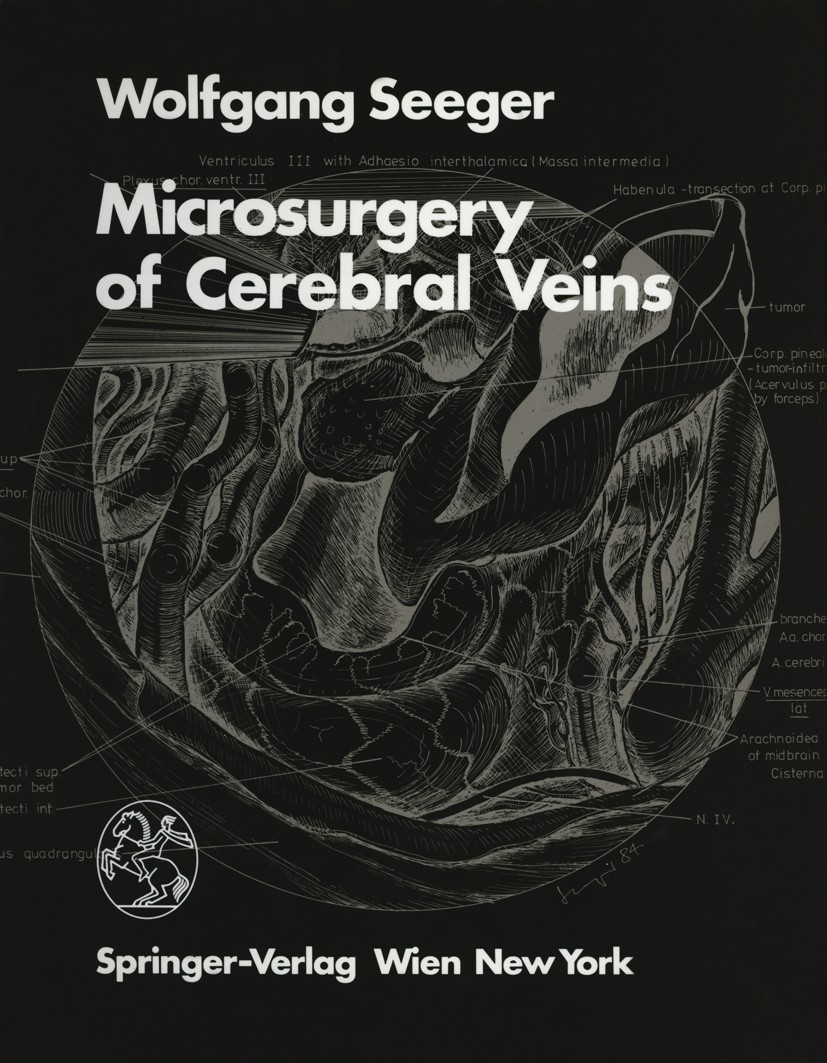 Titlebook: Microsurgery of Cerebral Veins; Wolfgang Seeger Book 1984 Springer-Verlag/Wien 1984 microsurgery.surgery Titlebook: Microsurgery of Cerebral Veins; Wolfgang Seeger Book 1984 Springer-Verlag/Wien 1984 microsurgery.surgery