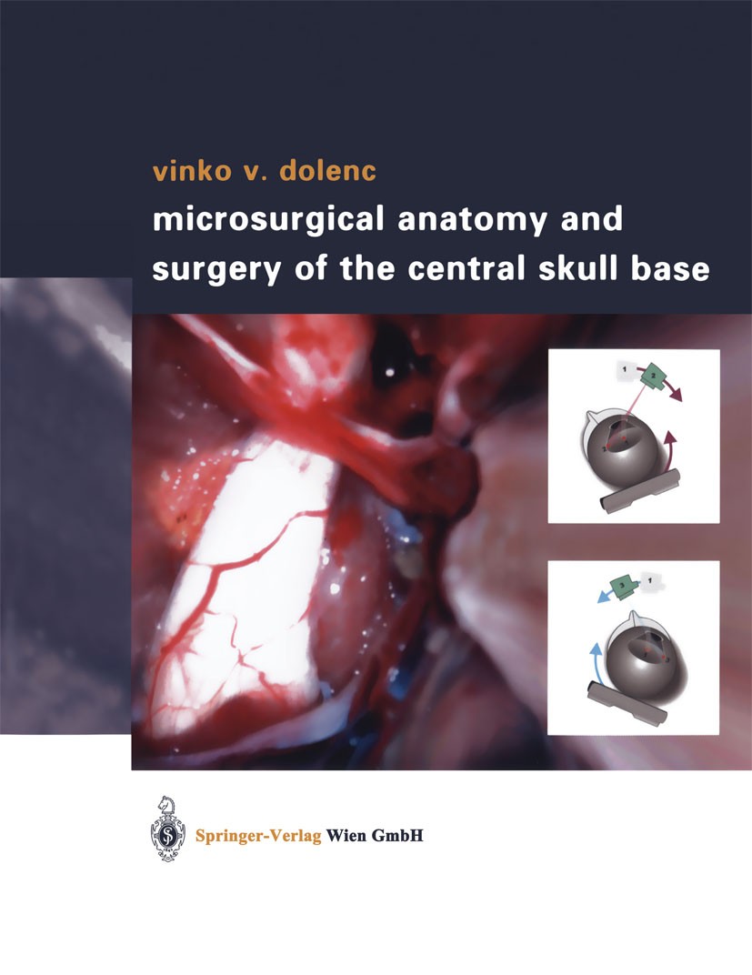 Titlebook: Microsurgical Anatomy and Surgery of the Central Skull Base; Vinko V. Dolenc Book 2003 Springer-Verlag Wien 2003 Tumor.aneurysm.cavernous Titlebook: Microsurgical Anatomy and Surgery of the Central Skull Base; Vinko V. Dolenc Book 2003 Springer-Verlag Wien 2003 Tumor.aneurysm.cavernous