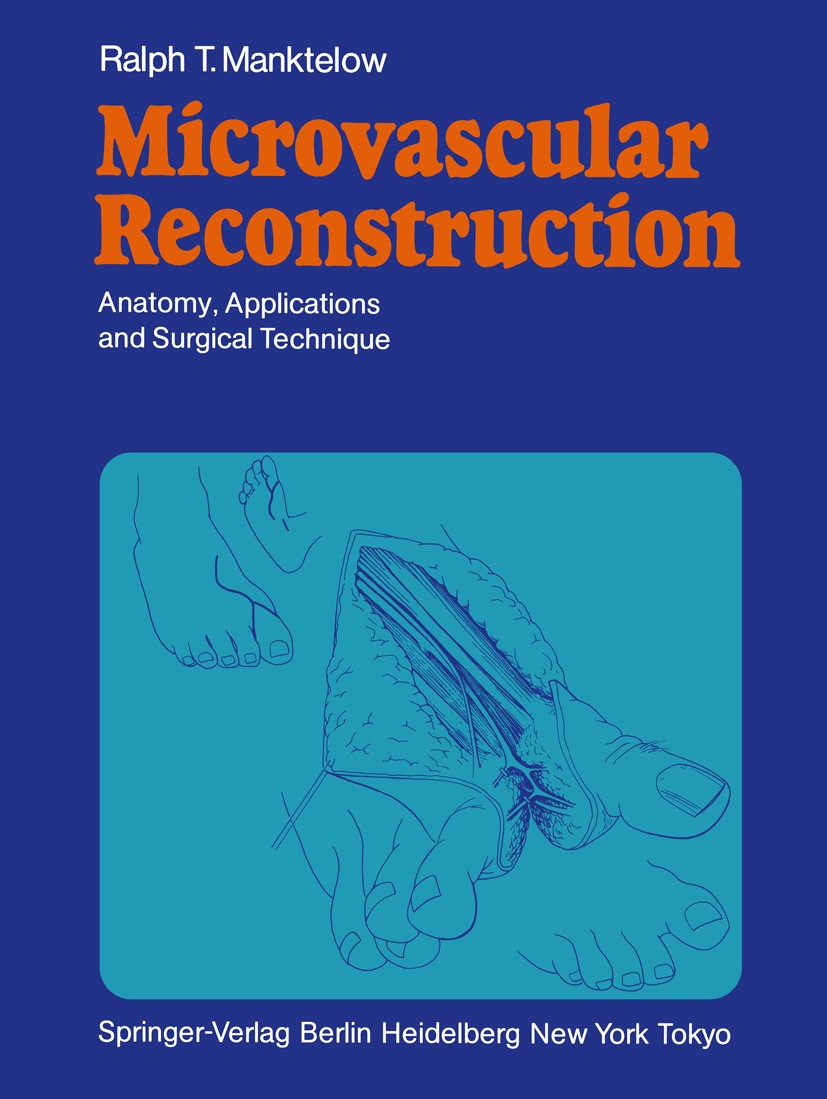 Titlebook: Microvascular Reconstruction; Anatomy, Application Ralph T. Manktelow Book 1986 Springer-Verlag Berlin Heidelberg 1986 Gefässchirurgie.chil Titlebook: Microvascular Reconstruction; Anatomy, Application Ralph T. Manktelow Book 1986 Springer-Verlag Berlin Heidelberg 1986 Gefässchirurgie.chil