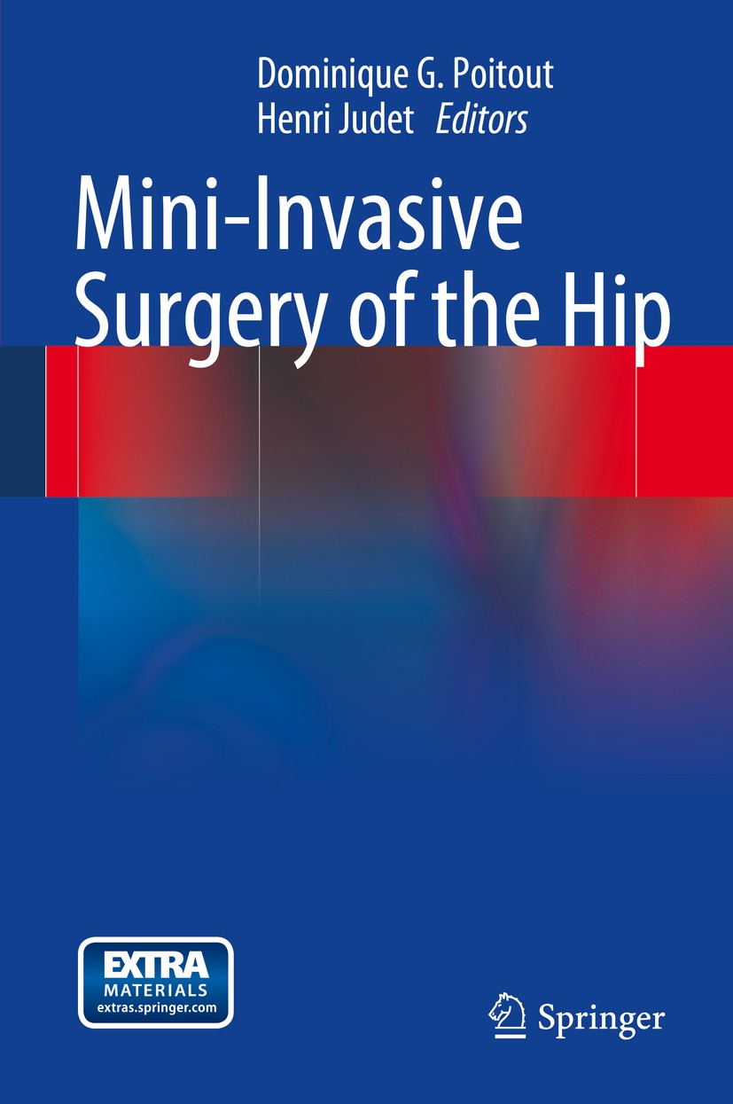 Titlebook: Mini-Invasive Surgery of the Hip; Dominique G. Poitout,Henri Judet Book 2014 The Editor(s) (if applicable) and The Author(s), under exclus Titlebook: Mini-Invasive Surgery of the Hip; Dominique G. Poitout,Henri Judet Book 2014 The Editor(s) (if applicable) and The Author(s), under exclus