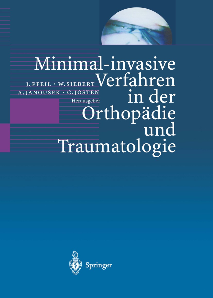 Titlebook: Minimal-invasive Verfahren in der Orthopädie und Traumatologie; J. Pfeil,W. Siebert,C. Josten Book 2000 Springer-Verlag Berlin Heidelberg Titlebook: Minimal-invasive Verfahren in der Orthopädie und Traumatologie; J. Pfeil,W. Siebert,C. Josten Book 2000 Springer-Verlag Berlin Heidelberg