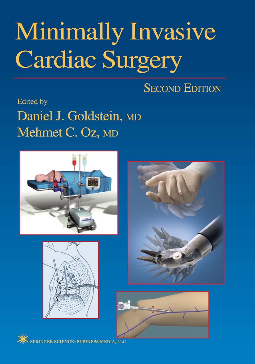 Titlebook: Minimally Invasive Cardiac Surgery; Daniel J. Goldstein,Mehmet C. Oz Book 2004 Springer Science+Business Media New York 2004 Bypass.atrial Titlebook: Minimally Invasive Cardiac Surgery; Daniel J. Goldstein,Mehmet C. Oz Book 2004 Springer Science+Business Media New York 2004 Bypass.atrial