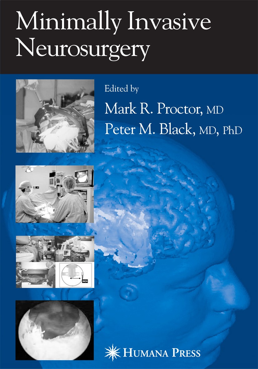Titlebook: Minimally Invasive Neurosurgery; Mark R. Proctor,Peter M. Black Book 2005 Humana Press 2005 aneurysm.brain.brain tumor.central nervous sys Titlebook: Minimally Invasive Neurosurgery; Mark R. Proctor,Peter M. Black Book 2005 Humana Press 2005 aneurysm.brain.brain tumor.central nervous sys