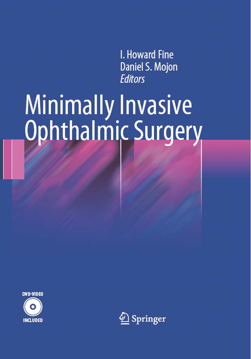Titlebook: Minimally Invasive Ophthalmic Surgery; I. Howard Fine,Daniel S. Mojon Book 2010 Springer-Verlag Berlin Heidelberg 2010 Corneal Surgery.Gla Titlebook: Minimally Invasive Ophthalmic Surgery; I. Howard Fine,Daniel S. Mojon Book 2010 Springer-Verlag Berlin Heidelberg 2010 Corneal Surgery.Gla