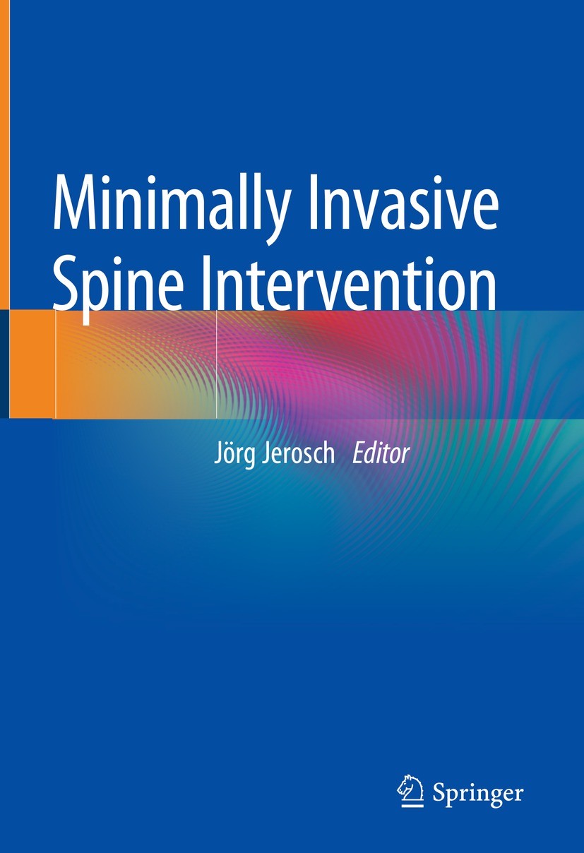 Titlebook: Minimally Invasive Spine Intervention; Jörg Jerosch Book 2023 Springer-Verlag GmbH Germany, part of Springer Nature 2023 Nucleoplastie.Fac Titlebook: Minimally Invasive Spine Intervention; Jörg Jerosch Book 2023 Springer-Verlag GmbH Germany, part of Springer Nature 2023 Nucleoplastie.Fac