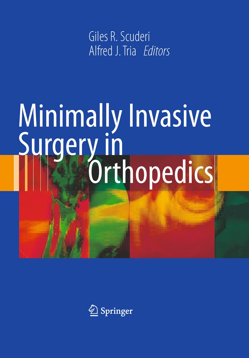 Titlebook: Minimally Invasive Surgery in Orthopedics; Giles R. Scuderi,Alfred J. Tria Book 20101st edition Springer-Verlag New York 2010 Hallux valgu Titlebook: Minimally Invasive Surgery in Orthopedics; Giles R. Scuderi,Alfred J. Tria Book 20101st edition Springer-Verlag New York 2010 Hallux valgu