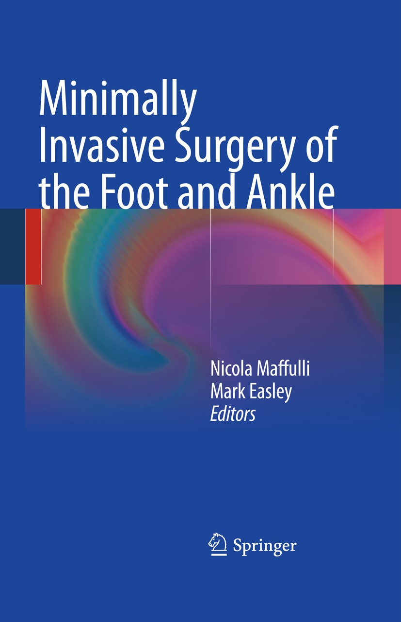 Titlebook: Minimally Invasive Surgery of the Foot and Ankle; Nicola Maffulli,Mark Easley Book 2011 Springer-Verlag London Limited 2011 Titlebook: Minimally Invasive Surgery of the Foot and Ankle; Nicola Maffulli,Mark Easley Book 2011 Springer-Verlag London Limited 2011