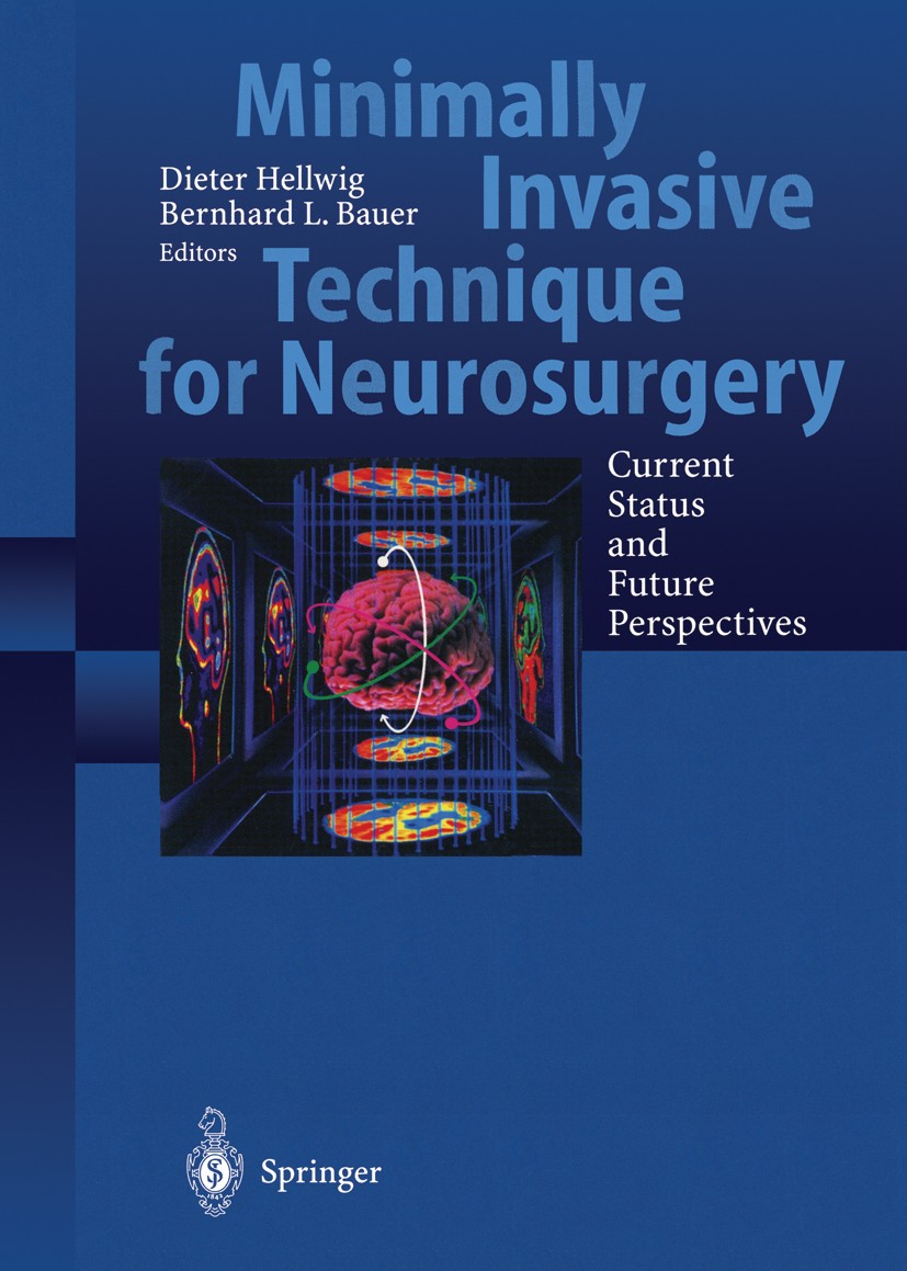 Titlebook: Minimally Invasive Techniques for Neurosurgery; Current Status and F Dieter Hellwig,Bernhard L. Bauer Conference proceedings 1998 Springer- Titlebook: Minimally Invasive Techniques for Neurosurgery; Current Status and F Dieter Hellwig,Bernhard L. Bauer Conference proceedings 1998 Springer-