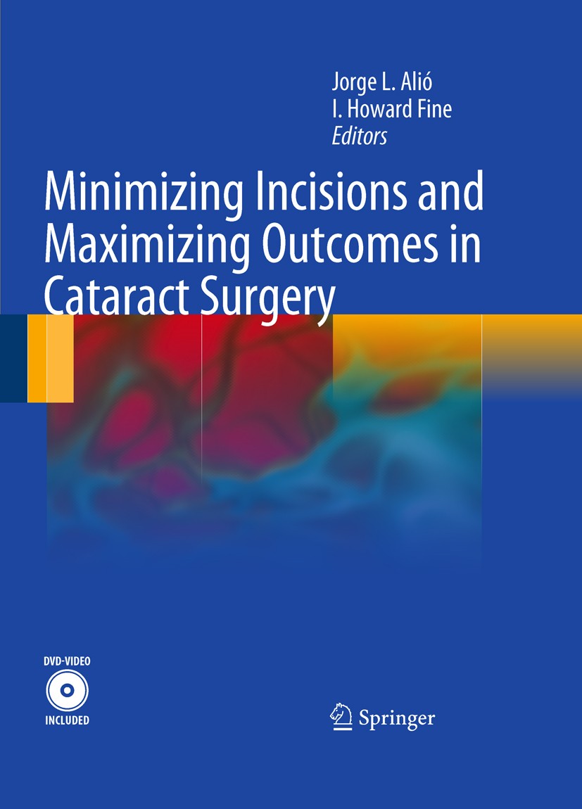 Titlebook: Minimizing Incisions and Maximizing Outcomes in Cataract Surgery; Jorge L. Alió (Professor and Chairman of Ophthalmo Book 2010 Springer-Ve Titlebook: Minimizing Incisions and Maximizing Outcomes in Cataract Surgery; Jorge L. Alió (Professor and Chairman of Ophthalmo Book 2010 Springer-Ve