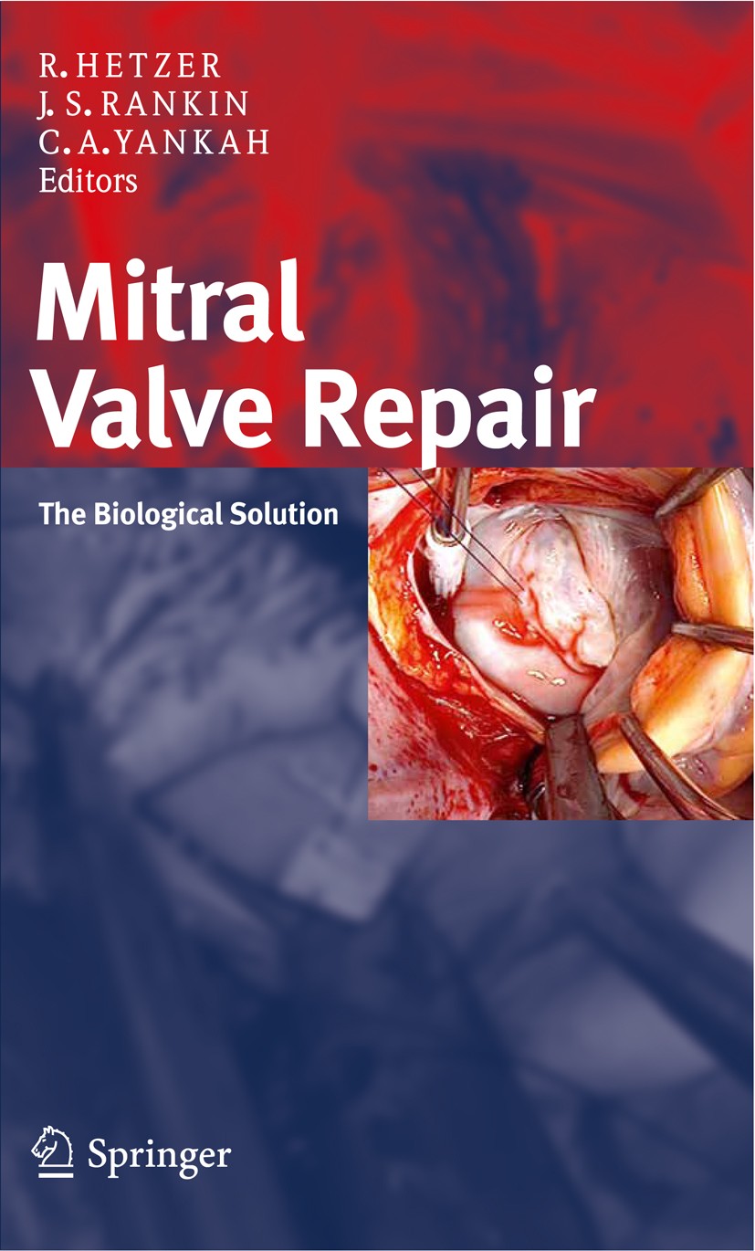 Titlebook: Mitral Valve Repair; The Biological Solut Roland Hetzer (Chairman Professor of Surgery),J. S Book 2011 Steinkopff-Verlag Darmstadt 2011 Mit Titlebook: Mitral Valve Repair; The Biological Solut Roland Hetzer (Chairman Professor of Surgery),J. S Book 2011 Steinkopff-Verlag Darmstadt 2011 Mit