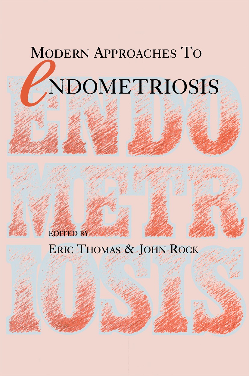 Titlebook: Modern Approaches to Endometriosis; Eric J. Thomas (Professor),John A. Rock (Professor Book 1991 Springer Science+Business Media Dordrecht Titlebook: Modern Approaches to Endometriosis; Eric J. Thomas (Professor),John A. Rock (Professor Book 1991 Springer Science+Business Media Dordrecht
