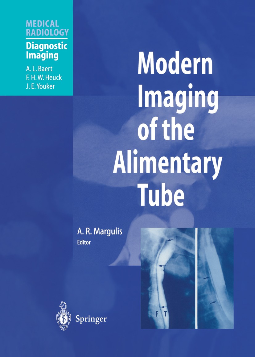 Titlebook: Modern Imaging of the Alimentary Tube; Alexander R. Margulis (Professor of Radiology) Book 2000 Springer-Verlag Berlin Heidelberg 2000 AID Titlebook: Modern Imaging of the Alimentary Tube; Alexander R. Margulis (Professor of Radiology) Book 2000 Springer-Verlag Berlin Heidelberg 2000 AID