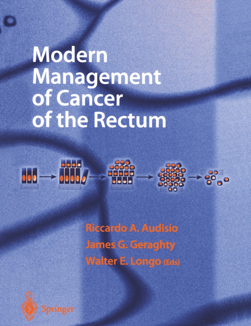 Titlebook: Modern Management of Cancer of the Rectum; Riccardo A. Audisio,James G. Geraghty,Walter E. Lo Book 20011st edition Springer-Verlag London Titlebook: Modern Management of Cancer of the Rectum; Riccardo A. Audisio,James G. Geraghty,Walter E. Lo Book 20011st edition Springer-Verlag London