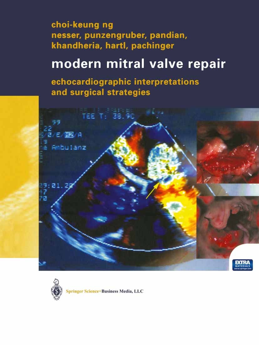 Titlebook: Modern Mitral Valve Repair; Echocardiographic In Choi-Keung Ng Book 2003 Springer-Verlag Wien 2003 3D-Echocardiography.Anuloplasty.Barlows‘ Titlebook: Modern Mitral Valve Repair; Echocardiographic In Choi-Keung Ng Book 2003 Springer-Verlag Wien 2003 3D-Echocardiography.Anuloplasty.Barlows‘