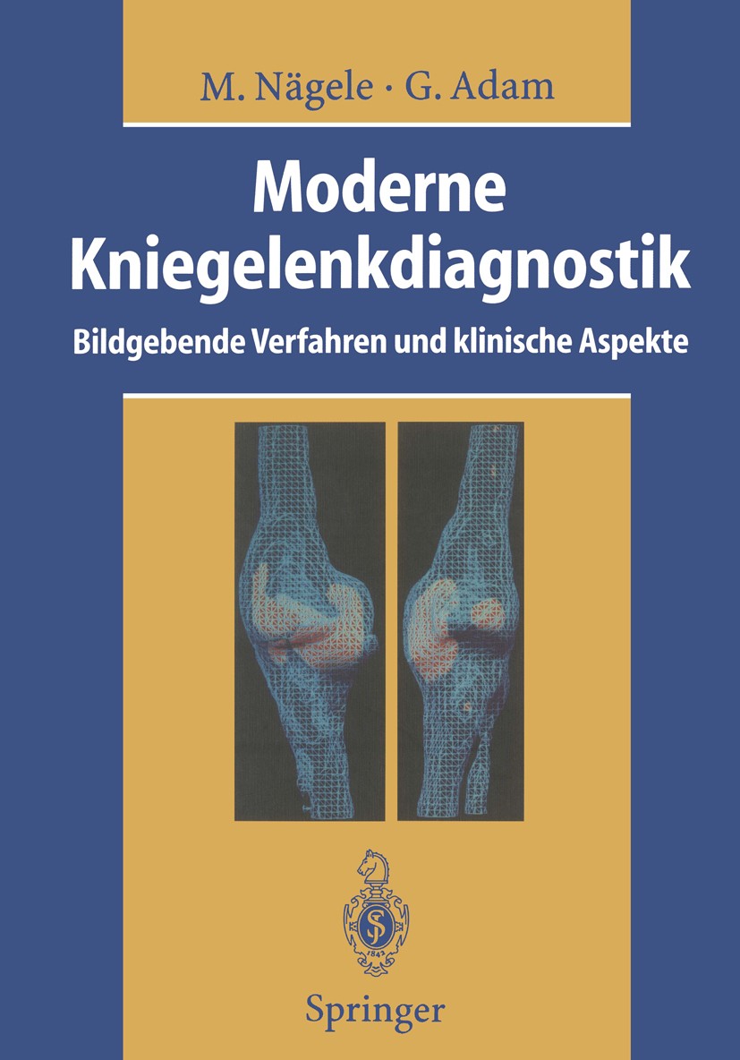 Titlebook: Moderne Kniegelenkdiagnostik; Bildgebende Verfahre Matthias Nägele,Gerhard Adam,G. Adam,J. L. Bloem,N Book 1995 Springer-Verlag Berlin Heid Titlebook: Moderne Kniegelenkdiagnostik; Bildgebende Verfahre Matthias Nägele,Gerhard Adam,G. Adam,J. L. Bloem,N Book 1995 Springer-Verlag Berlin Heid