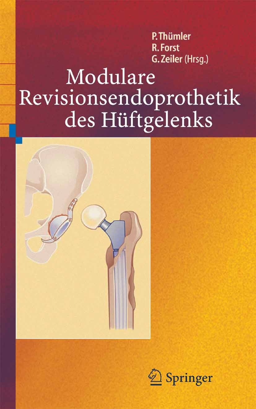 Titlebook: Modulare Revisionsendoprothetik des Hüftgelenks; Peter Thümler (Professor, Dr. med.),Raimund Forst Book 2005 Springer-Verlag Berlin Heide Titlebook: Modulare Revisionsendoprothetik des Hüftgelenks; Peter Thümler (Professor, Dr. med.),Raimund Forst Book 2005 Springer-Verlag Berlin Heide