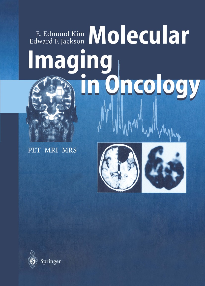 Titlebook: Molecular Imaging in Oncology; PET, MRI, and MRS E. Edmund Kim,Edward F. Jackson Book 1999 Springer-Verlag Berlin Heidelberg 1999 Tumor.bra Titlebook: Molecular Imaging in Oncology; PET, MRI, and MRS E. Edmund Kim,Edward F. Jackson Book 1999 Springer-Verlag Berlin Heidelberg 1999 Tumor.bra