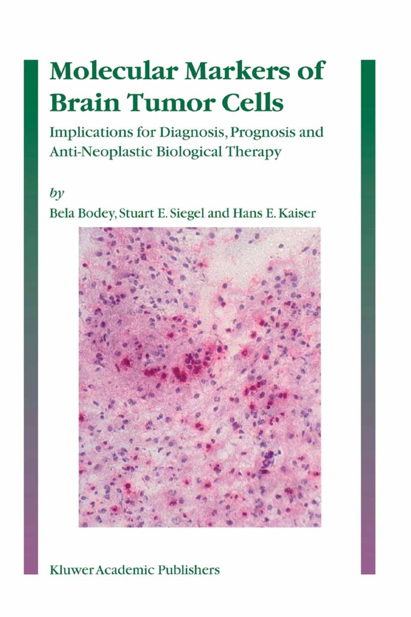 Titlebook: Molecular Markers of Brain Tumor Cells; Implications for Dia Bela Bodey,Stuart E. Siegel,Hans E. Kaiser Book 2005 Springer Science+Business Titlebook: Molecular Markers of Brain Tumor Cells; Implications for Dia Bela Bodey,Stuart E. Siegel,Hans E. Kaiser Book 2005 Springer Science+Business