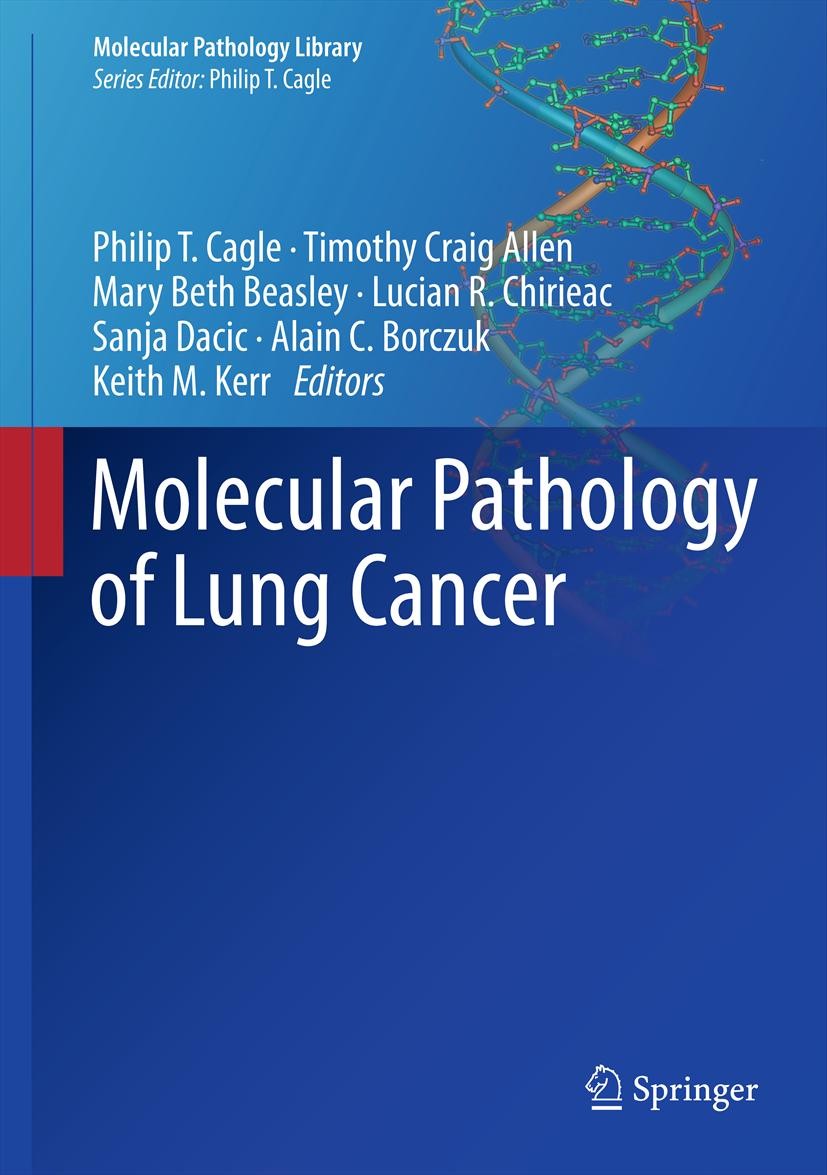 Titlebook: Molecular Pathology of Lung Cancer; Philip T. Cagle,Timothy Craig Allen,Keith M. Kerr Book 20121st edition Springer Science+Business Media Titlebook: Molecular Pathology of Lung Cancer; Philip T. Cagle,Timothy Craig Allen,Keith M. Kerr Book 20121st edition Springer Science+Business Media