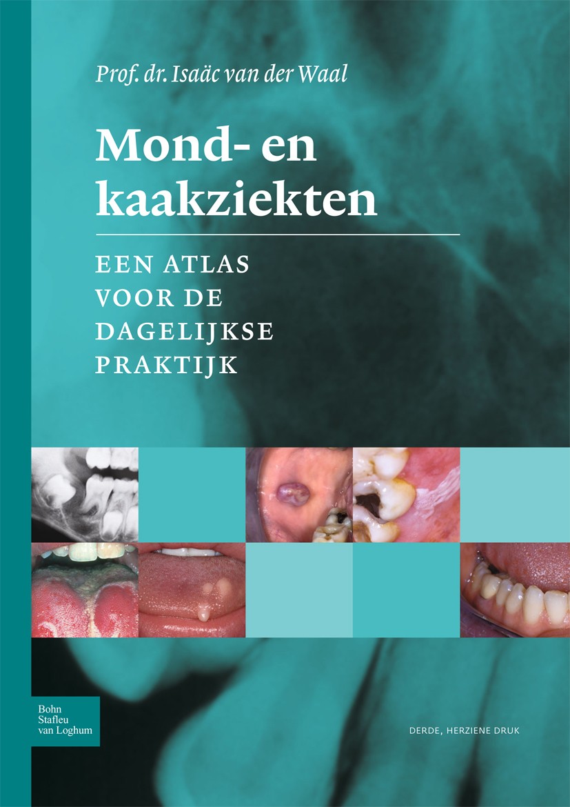 Titlebook: Mond- en kaakziekten; Een atlas voor de da Isaäc Waal Book 2015Latest edition Bohn Stafleu van Loghum 2015 aandoeningen van het gehemelte.b Titlebook: Mond- en kaakziekten; Een atlas voor de da Isaäc Waal Book 2015Latest edition Bohn Stafleu van Loghum 2015 aandoeningen van het gehemelte.b