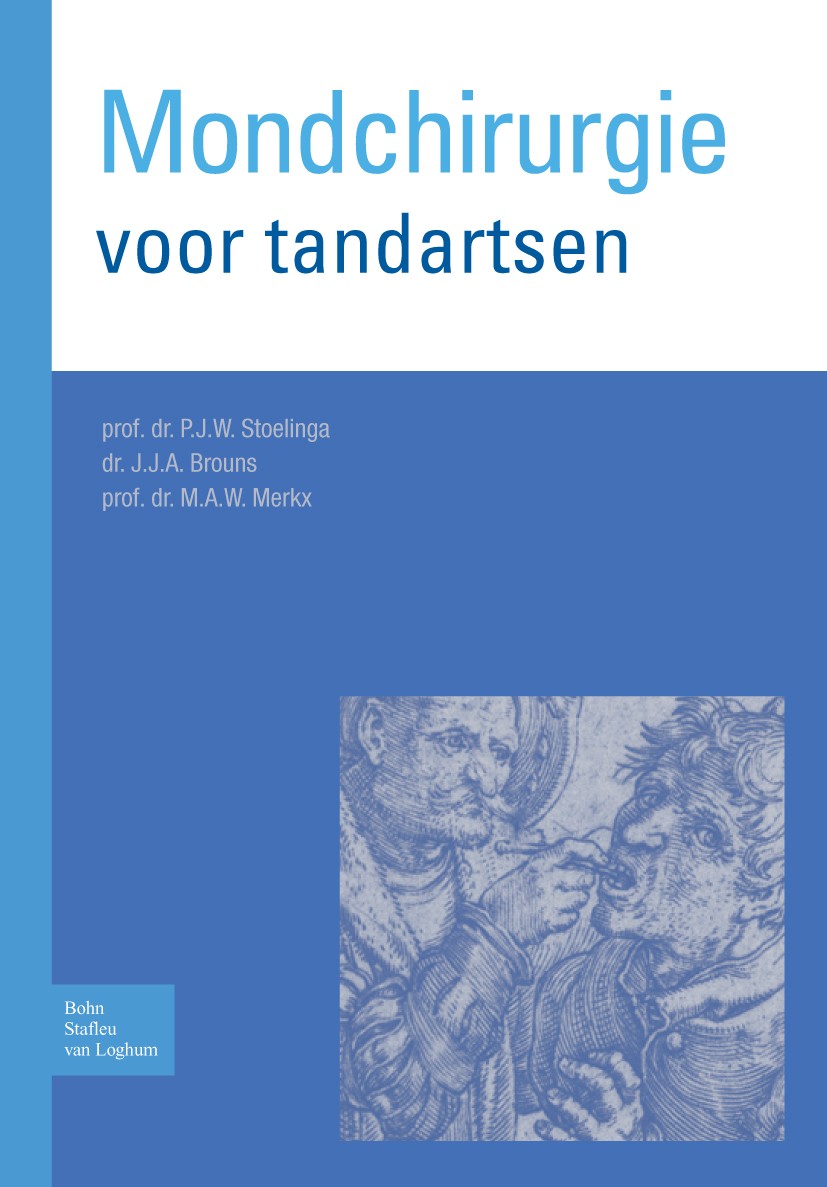 Titlebook: Mondchirurgie voor tandartsen; P.J.W. Stoelinga,J.J.A. Brouns,M.A.W. Merkx Book 2009Latest edition Bohn Stafleu van Loghum 2009 Titlebook: Mondchirurgie voor tandartsen; P.J.W. Stoelinga,J.J.A. Brouns,M.A.W. Merkx Book 2009Latest edition Bohn Stafleu van Loghum 2009