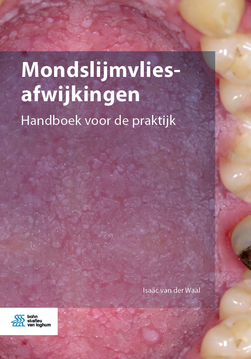 Titlebook: Mondslijmvliesafwijkingen; Handboek voor de pra Isaäc van der Waal Book 2020Latest edition Bohn Stafleu van Loghum is een imprint van Sprin Titlebook: Mondslijmvliesafwijkingen; Handboek voor de pra Isaäc van der Waal Book 2020Latest edition Bohn Stafleu van Loghum is een imprint van Sprin