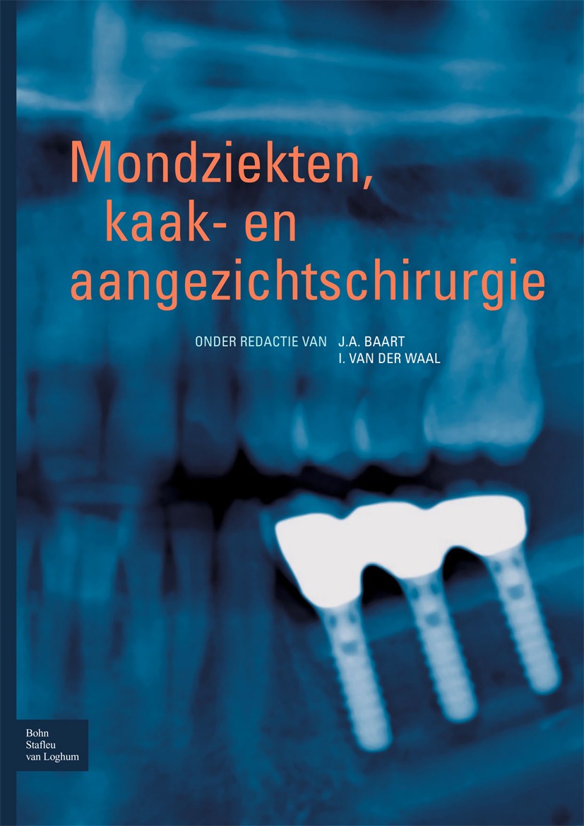 Titlebook: Mondziekten, kaak- en aangezichtschirurgie; J. A. Baart,I. Waal Book 2009Latest edition Bohn Stafleu van Loghum 2009 Titlebook: Mondziekten, kaak- en aangezichtschirurgie; J. A. Baart,I. Waal Book 2009Latest edition Bohn Stafleu van Loghum 2009