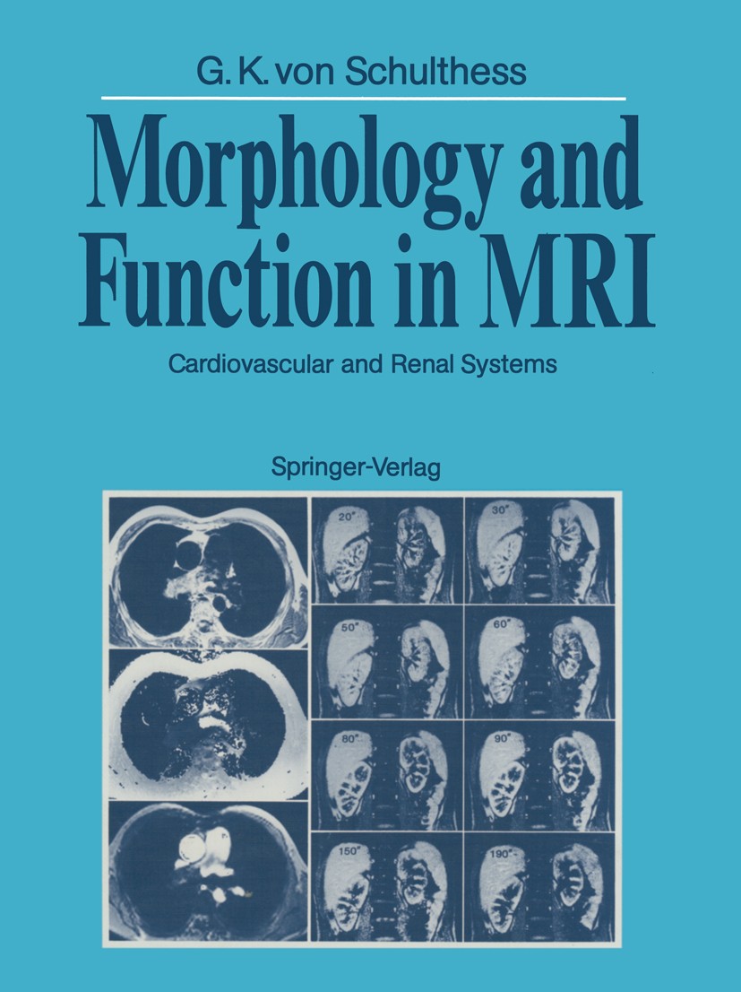 Titlebook: Morphology and Function in MRI; Cardiovascular and R Gustav Konrad Schulthess Book 1989 Springer-Verlag Berlin Heidelberg 1989 anatomy.angi Titlebook: Morphology and Function in MRI; Cardiovascular and R Gustav Konrad Schulthess Book 1989 Springer-Verlag Berlin Heidelberg 1989 anatomy.angi