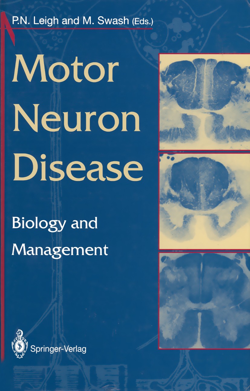 Titlebook: Motor Neuron Disease; Biology and Manageme P. N. Leigh (Professor),Michael Swash (Consultant Book 1995 Springer-Verlag London Limited 1995 Titlebook: Motor Neuron Disease; Biology and Manageme P. N. Leigh (Professor),Michael Swash (Consultant Book 1995 Springer-Verlag London Limited 1995
