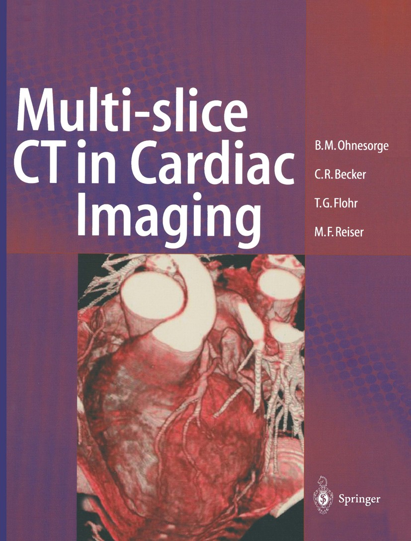 Titlebook: Multi-slice CT in Cardiac Imaging; Technical Principles Bernd M. Ohnesorge,Christoph R. Becker,Maximilian Book 20021st edition Springer-Ve Titlebook: Multi-slice CT in Cardiac Imaging; Technical Principles Bernd M. Ohnesorge,Christoph R. Becker,Maximilian Book 20021st edition Springer-Ve