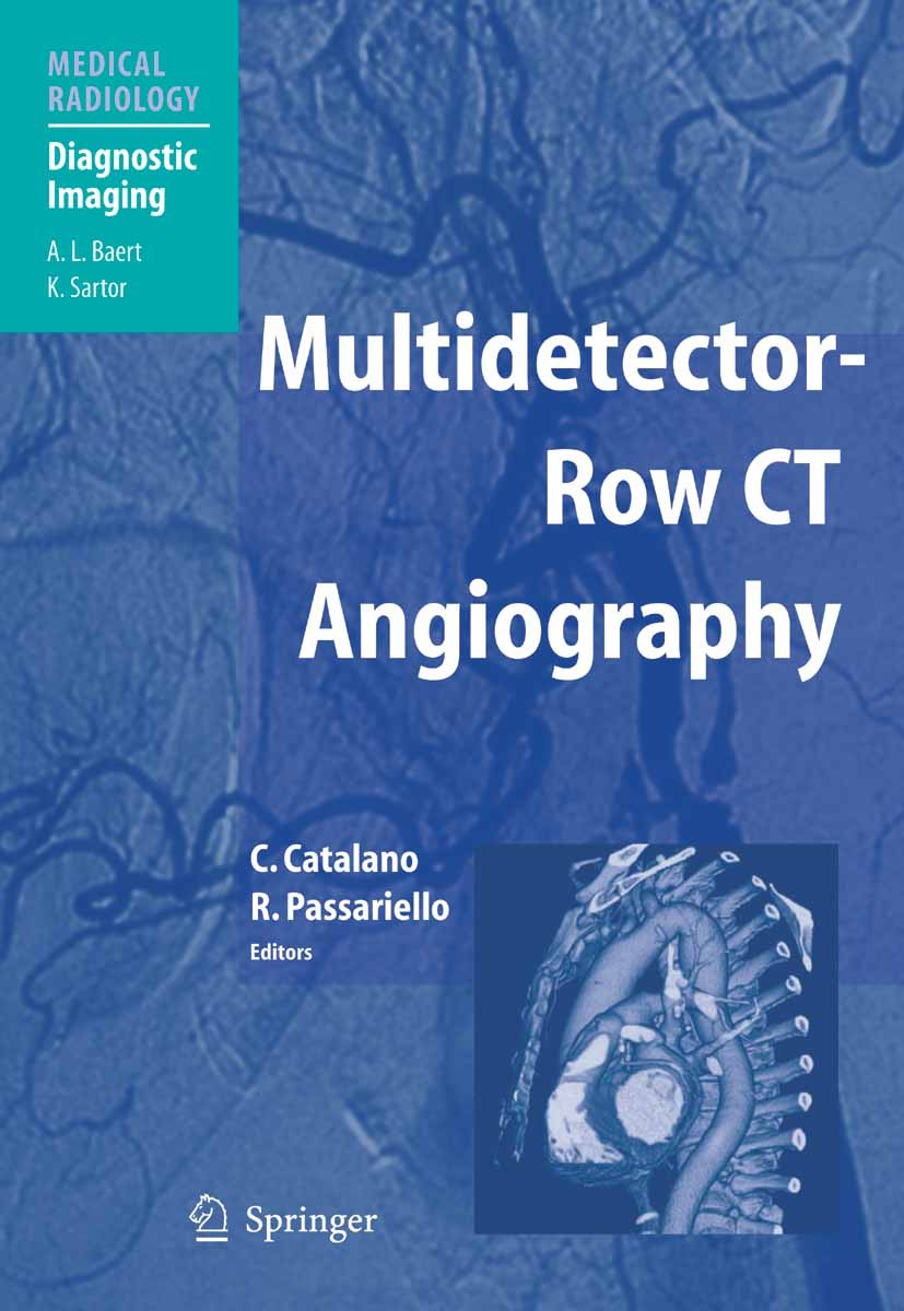 Titlebook: Multidetector-Row CT Angiography; Carlo Catalano (Associate Professor),Roberto Passa Book 2005 Springer-Verlag Berlin Heidelberg 2005 Comp Titlebook: Multidetector-Row CT Angiography; Carlo Catalano (Associate Professor),Roberto Passa Book 2005 Springer-Verlag Berlin Heidelberg 2005 Comp