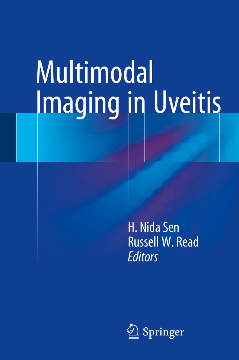 Titlebook: Multimodal Imaging in Uveitis; H. Nida Sen,Russell W. Read Book 2018 Springer International Publishing AG 2018 Angiography.Autoflourescenc Titlebook: Multimodal Imaging in Uveitis; H. Nida Sen,Russell W. Read Book 2018 Springer International Publishing AG 2018 Angiography.Autoflourescenc