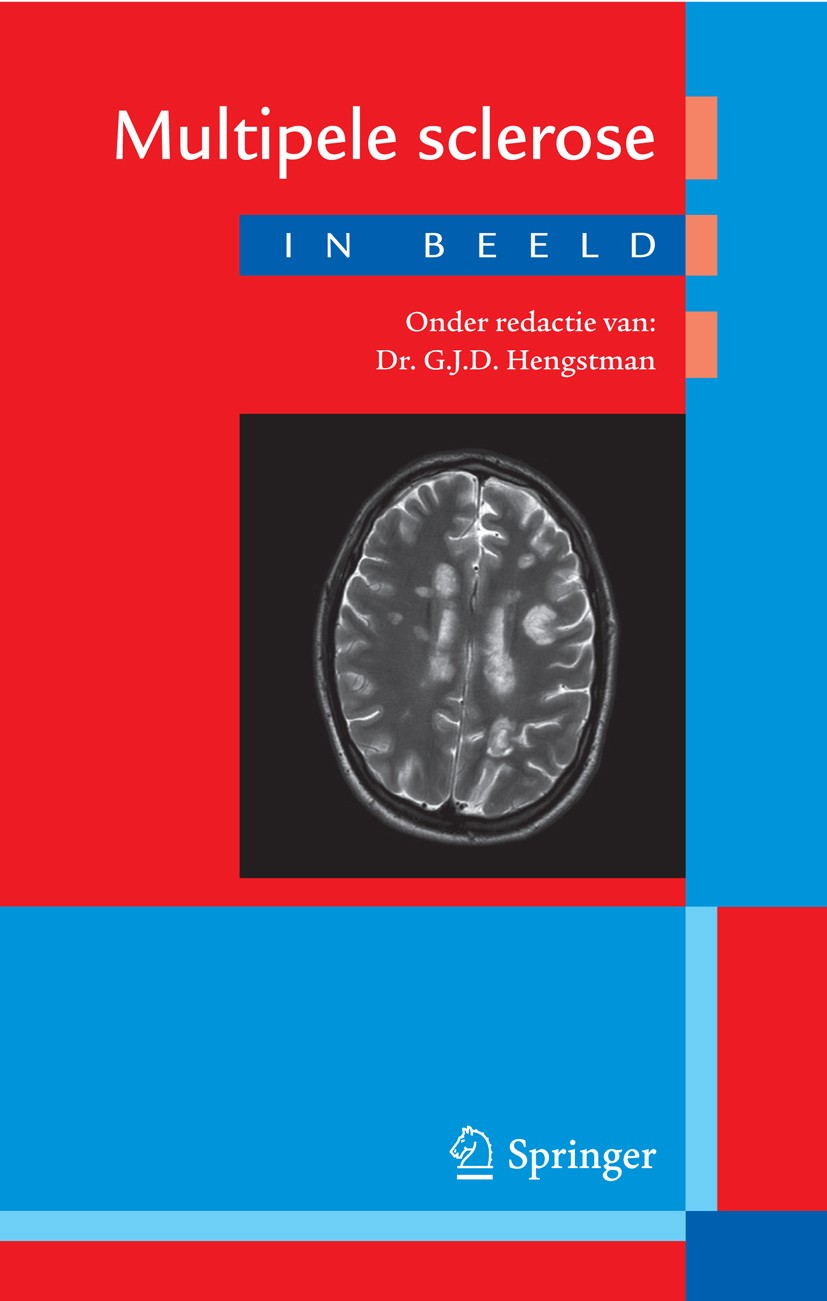 Titlebook: Multipele sclerose in beeld; G.J.D. Hengstman Book 2013Latest edition Bohn Stafleu van Loghum 2013 Titlebook: Multipele sclerose in beeld; G.J.D. Hengstman Book 2013Latest edition Bohn Stafleu van Loghum 2013
