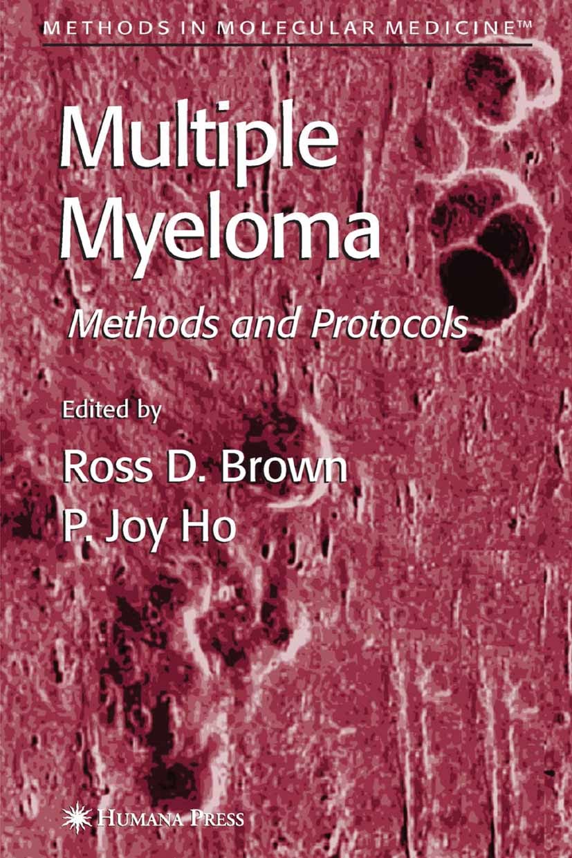Titlebook: Multiple Myeloma; Methods and Protocol Ross D. Brown,P. Joy Ho Book 2005 Humana Press 2005 DNA.cell.cytogenetics.genetics.pathogenesis.plas Titlebook: Multiple Myeloma; Methods and Protocol Ross D. Brown,P. Joy Ho Book 2005 Humana Press 2005 DNA.cell.cytogenetics.genetics.pathogenesis.plas