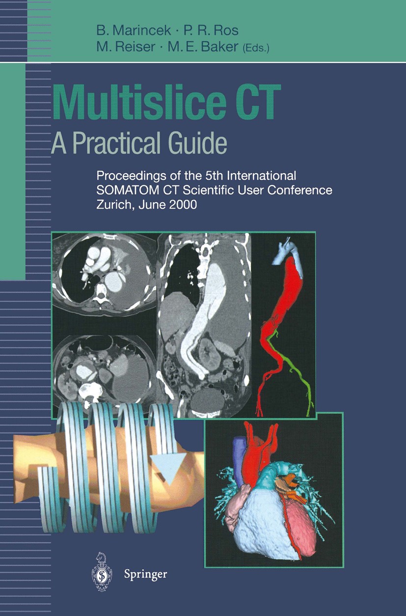 Titlebook: Multislice CT: A Practical Guide; Proceedings of the 5 Borut Marincek (Professor and Chairman),Pablo R. R Conference proceedings 2001 Sprin Titlebook: Multislice CT: A Practical Guide; Proceedings of the 5 Borut Marincek (Professor and Chairman),Pablo R. R Conference proceedings 2001 Sprin