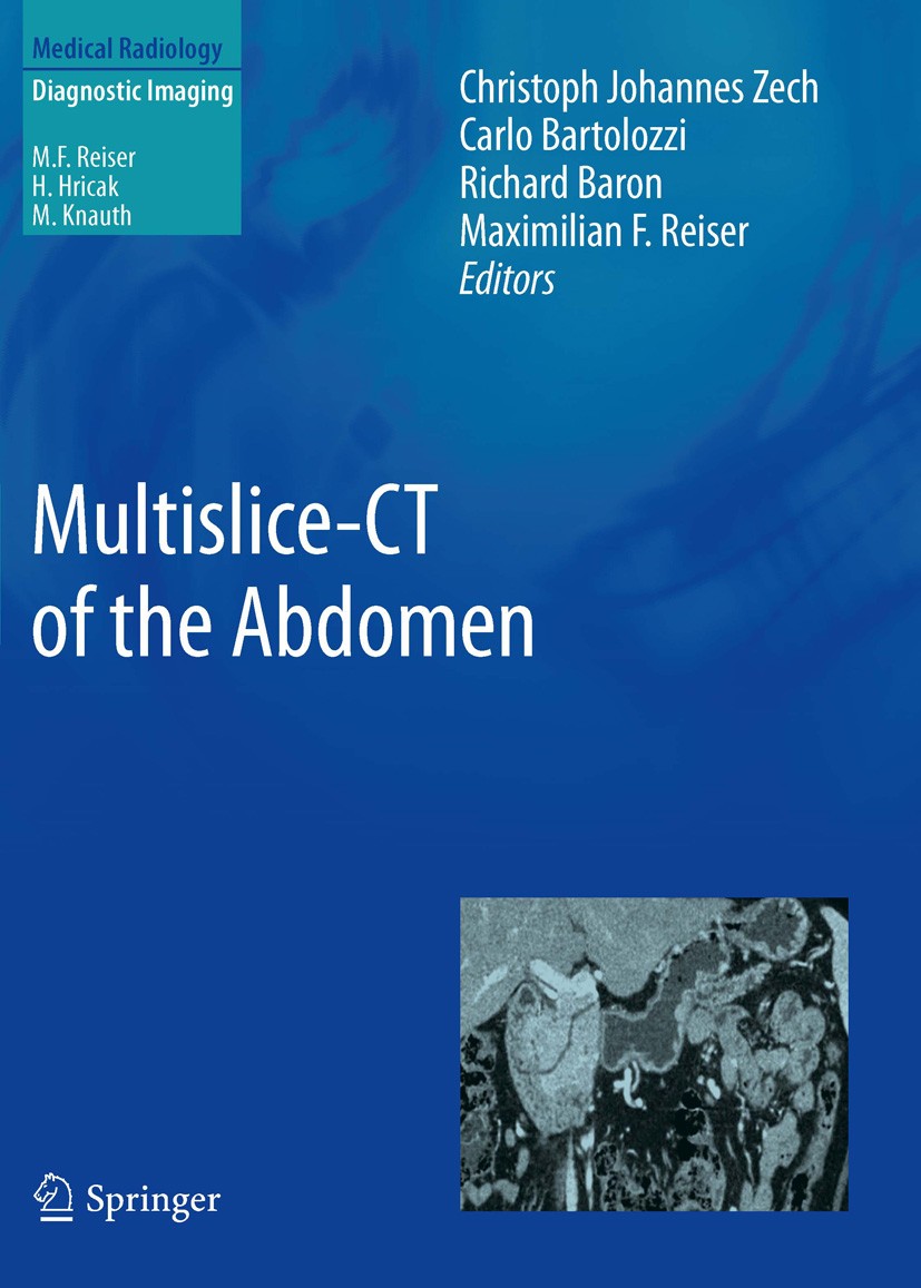 Titlebook: Multislice-CT of the Abdomen; Christoph Johannes Zech,Carlo Bartolozzi,Maximilia Book 2012 Springer-Verlag Berlin Heidelberg 2012 Bowel.Co Titlebook: Multislice-CT of the Abdomen; Christoph Johannes Zech,Carlo Bartolozzi,Maximilia Book 2012 Springer-Verlag Berlin Heidelberg 2012 Bowel.Co