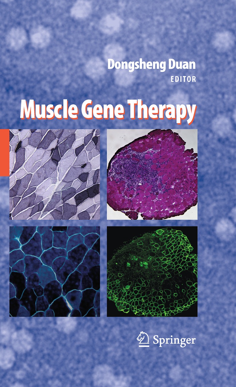 Titlebook: Muscle Gene Therapy; Dongsheng Duan Book 20101st edition Springer-Verlag New York 2010 clinical trial.development.diseases.gene.gene thera Titlebook: Muscle Gene Therapy; Dongsheng Duan Book 20101st edition Springer-Verlag New York 2010 clinical trial.development.diseases.gene.gene thera