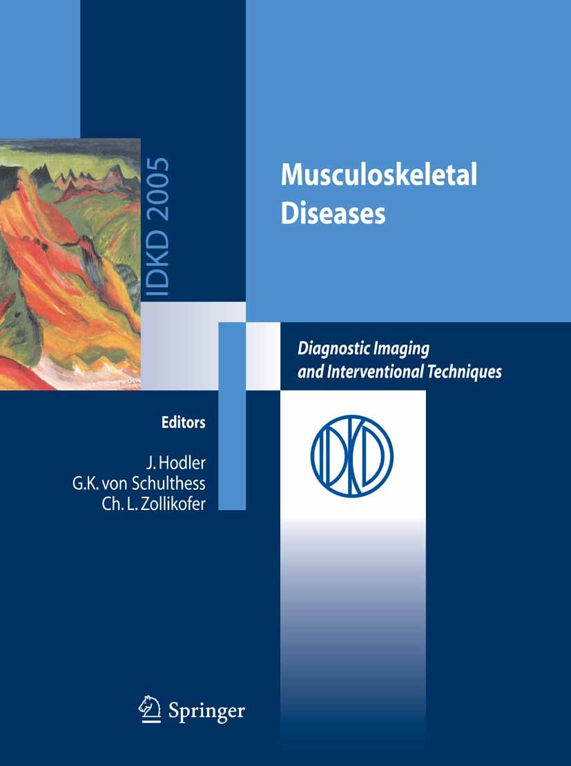 Titlebook: Musculoskeletal Diseases; Diagnostic Imaging a J. Hodler,Ch. L. Zollikofer,G. K. Schulthess Book 2005 Springer-Verlag Milan 2005 Radiology. Titlebook: Musculoskeletal Diseases; Diagnostic Imaging a J. Hodler,Ch. L. Zollikofer,G. K. Schulthess Book 2005 Springer-Verlag Milan 2005 Radiology.