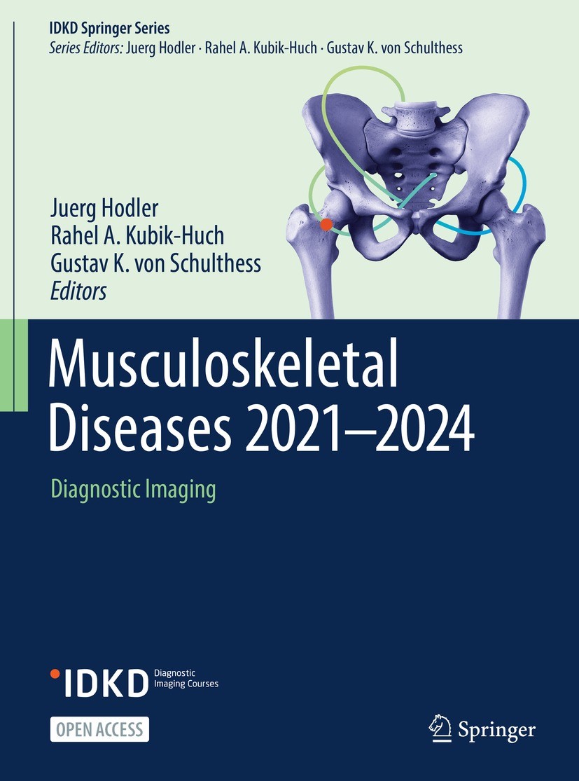 Titlebook: Musculoskeletal Diseases 2021-2024; Diagnostic Imaging Juerg Hodler,Rahel A. Kubik-Huch,Gustav K. von Sch Book‘‘‘‘‘‘‘‘ 2021 The Editor(s) ( Titlebook: Musculoskeletal Diseases 2021-2024; Diagnostic Imaging Juerg Hodler,Rahel A. Kubik-Huch,Gustav K. von Sch Book‘‘‘‘‘‘‘‘ 2021 The Editor(s) (