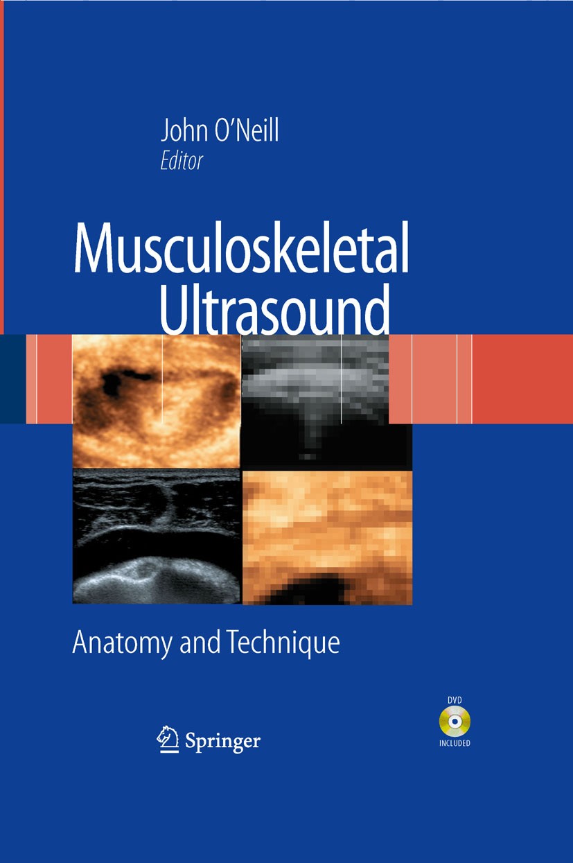 Titlebook: Musculoskeletal Ultrasound; Anatomy and Techniqu John M.D. O’Neill (Assistant Professor) Book 2008 The Editor(s) (if applicable) and The Au Titlebook: Musculoskeletal Ultrasound; Anatomy and Techniqu John M.D. O’Neill (Assistant Professor) Book 2008 The Editor(s) (if applicable) and The Au