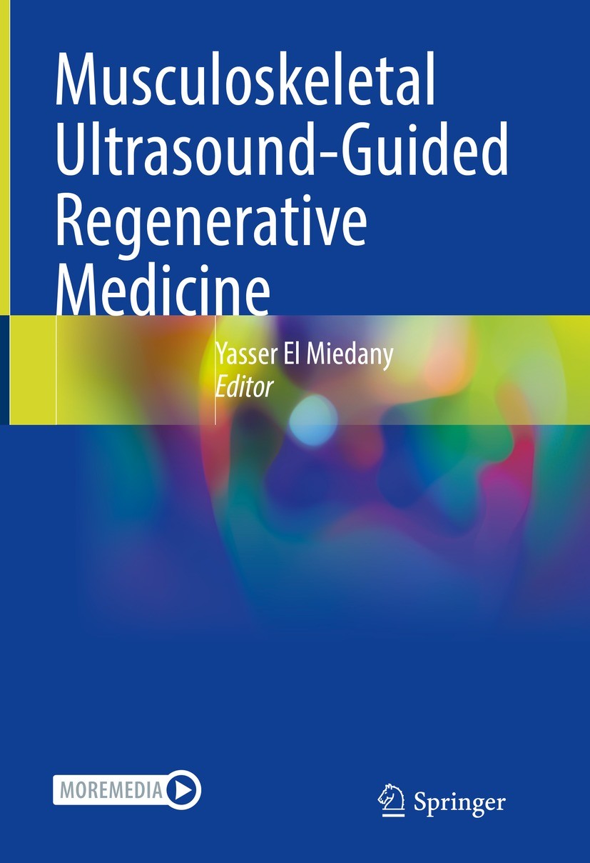 Titlebook: Musculoskeletal Ultrasound-Guided Regenerative Medicine; Yasser El Miedany Book 2022 Springer Nature Switzerland AG 2022 Diagnostic and in Titlebook: Musculoskeletal Ultrasound-Guided Regenerative Medicine; Yasser El Miedany Book 2022 Springer Nature Switzerland AG 2022 Diagnostic and in