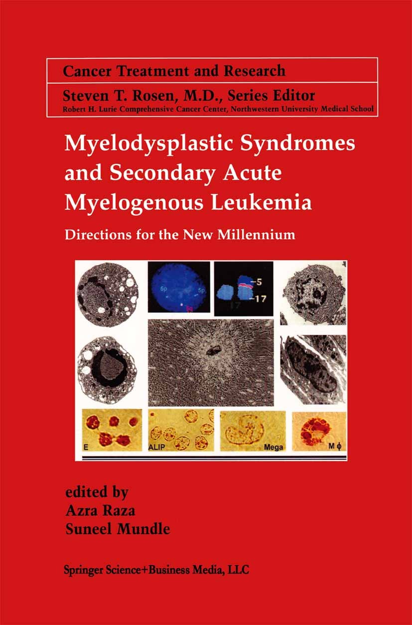 Titlebook: Myelodysplastic Syndromes & Secondary Acute Myelogenous Leukemia; Directions for the N Azra Raza (Director),Suneel D. Mundle (Assistant P B Titlebook: Myelodysplastic Syndromes & Secondary Acute Myelogenous Leukemia; Directions for the N Azra Raza (Director),Suneel D. Mundle (Assistant P B
