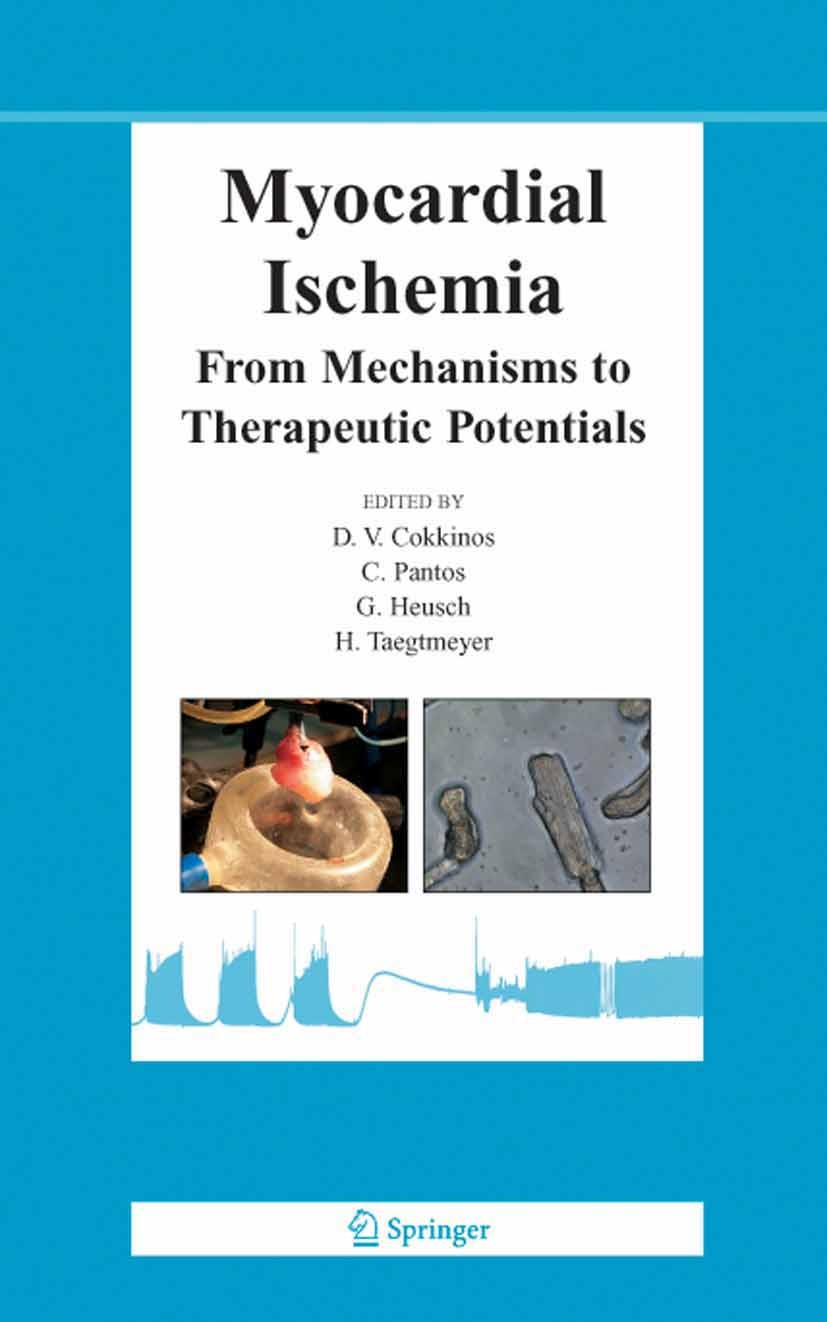 Titlebook: Myocardial Ischemia; From Mechanisms to T Dennis V. Cokkinos (Prof. of Cardiology, Chairman) Book 2006 Springer-Verlag US 2006 adaptation.d Titlebook: Myocardial Ischemia; From Mechanisms to T Dennis V. Cokkinos (Prof. of Cardiology, Chairman) Book 2006 Springer-Verlag US 2006 adaptation.d