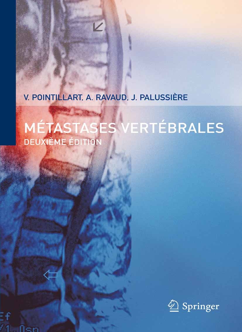 Titlebook: Métastases vertébrales; Vincent Pointillart,Alain Ravaud,Jean Palussière Book 2007Latest edition Springer-Verlag Paris 2007 Biopsie.Chirur Titlebook: Métastases vertébrales; Vincent Pointillart,Alain Ravaud,Jean Palussière Book 2007Latest edition Springer-Verlag Paris 2007 Biopsie.Chirur