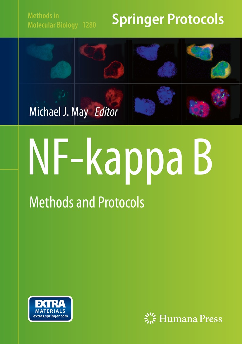 Titlebook: NF-kappa B; Methods and Protocol Michael J. May Book 2015 Springer Science+Business Media New York 2015 DELFIA.Electrophoretic Mobility Shi Titlebook: NF-kappa B; Methods and Protocol Michael J. May Book 2015 Springer Science+Business Media New York 2015 DELFIA.Electrophoretic Mobility Shi