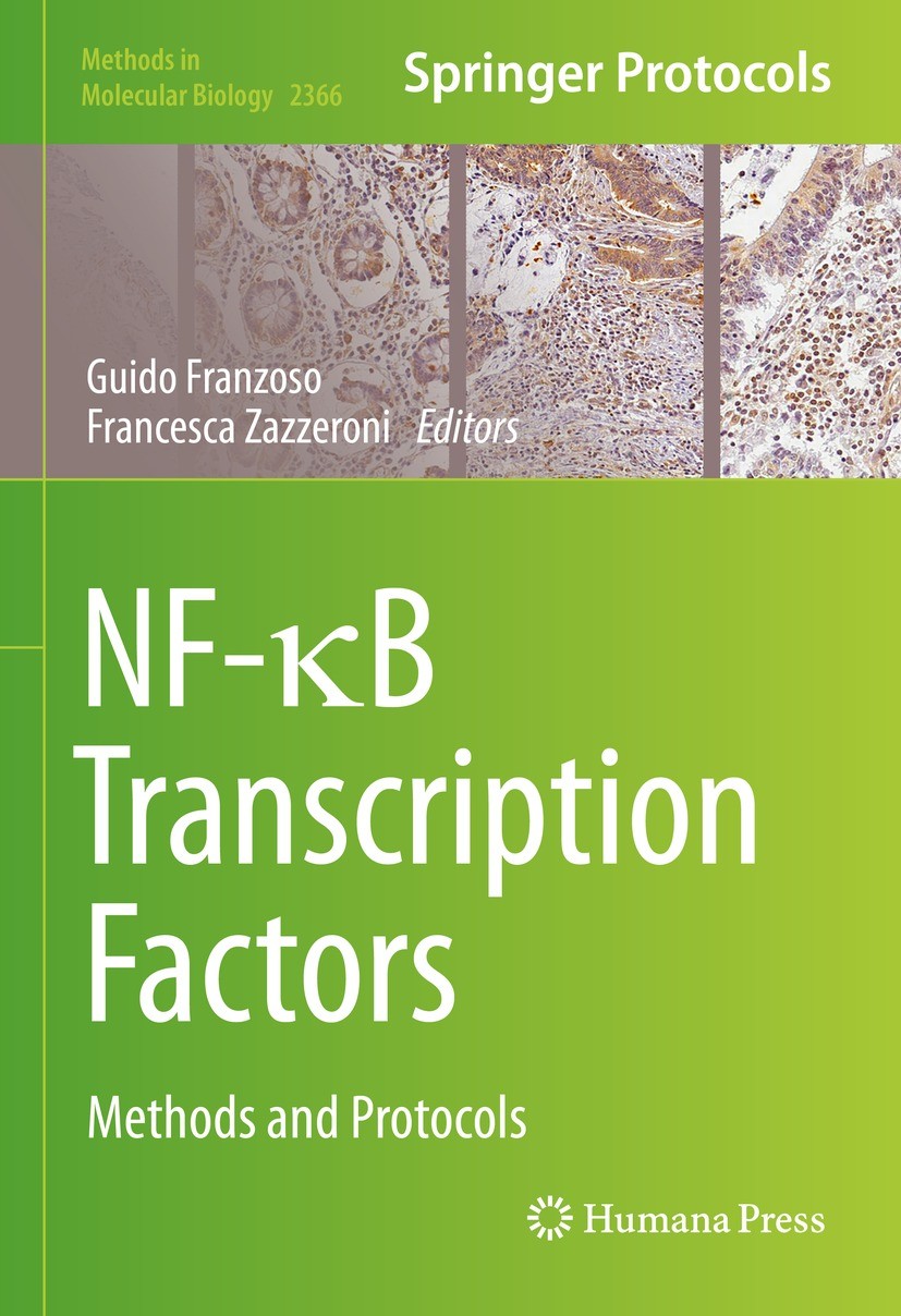 Titlebook: NF-κB Transcription Factors; Methods and Protocol Guido Franzoso,Francesca Zazzeroni Book 2021 Springer Science+Business Media, LLC, part o Titlebook: NF-κB Transcription Factors; Methods and Protocol Guido Franzoso,Francesca Zazzeroni Book 2021 Springer Science+Business Media, LLC, part o
