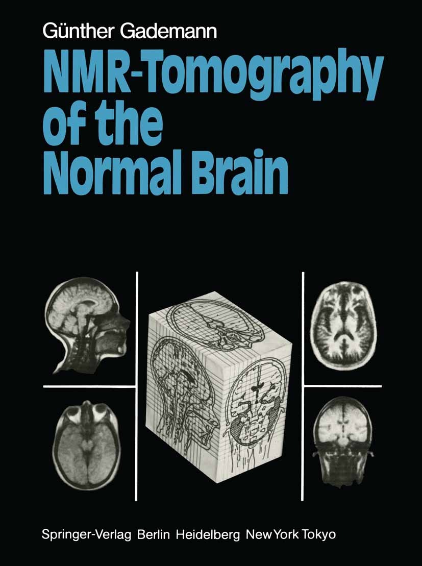 Titlebook: NMR-Tomography of the Normal Brain; Günther Gademann Book 1984 Springer-Verlag Berlin Heidelberg 1984 Gehirn.Kernspintomographie.MR imagin Titlebook: NMR-Tomography of the Normal Brain; Günther Gademann Book 1984 Springer-Verlag Berlin Heidelberg 1984 Gehirn.Kernspintomographie.MR imagin